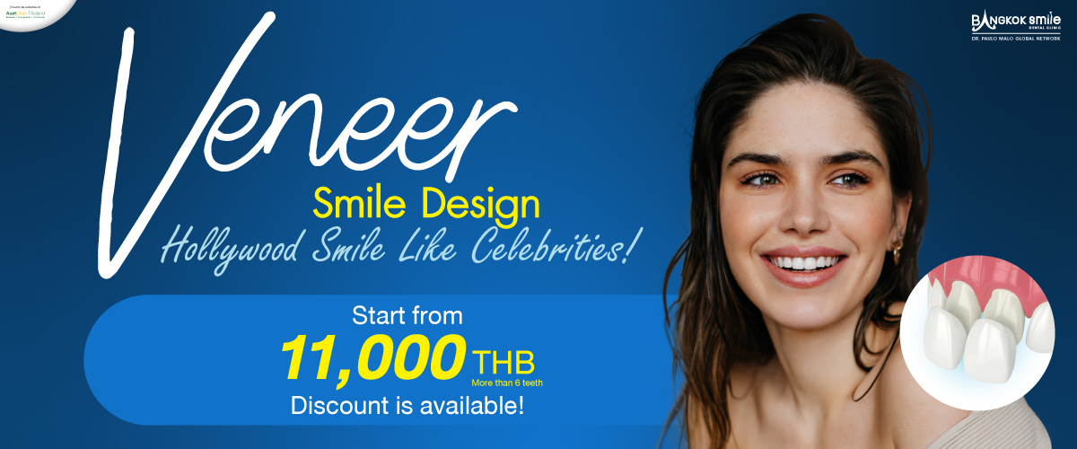 Digital Veneers By Bangkok Smile Dental Clinic
